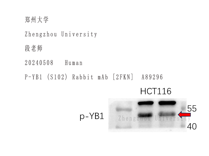 使用Nature Biosciences品牌抗体 Review 持续更新00001